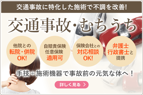 オファーバナー